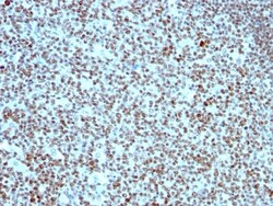 Nucleolin Antibody (SPM614), Novus Biologicals 0.2mg; Unlabeled:Antibodies,